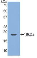 THBD / CD141 / Thrombomodulin Antibody (aa31-167)