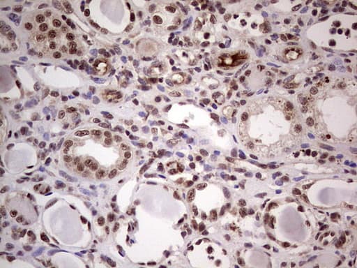 LPIN1 / Lipin 1 Antibody (aa1-274, clone OTI2H6)