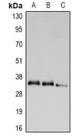 Polyclonal Rabbit anti-Human UCP2 Antibody (IHC, WB)
