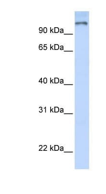 PARP9 Antibody (aa144-193)