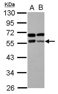 ZBTB9 Antibody