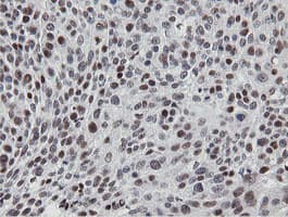 MIPEP Antibody (aa174-516, clone OTI3F8, Carrier-free)