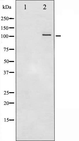 PRKD1 / PKC Mu Antibody (phospho-Ser738,pSer742)