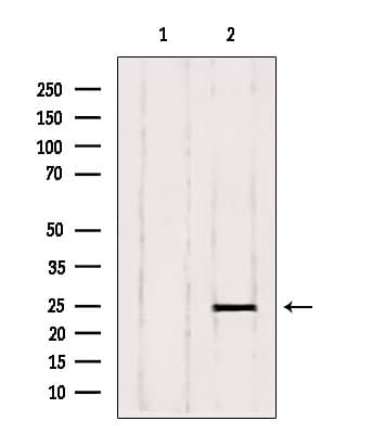 Polyclonal Rabbit anti-Human RAB6A / RAB6 Antibody (IF, WB)