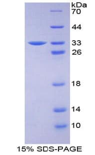Bovine F3 / CD142 / Tissue factor Protein (Recombinant His-T7)