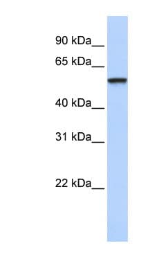 TRIM4 / RNF87 Antibody (aa107-156)