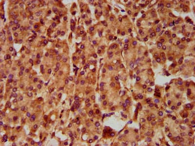 SLC5A5 / NIS Antibody