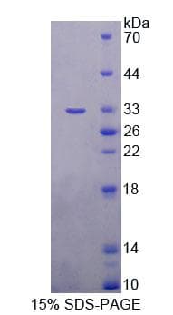 Human AGXT2 Protein (Recombinant His-T7, N-terminus)