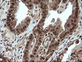 VHL / Von Hippel Lindau Antibody (clone OTI1E1)
