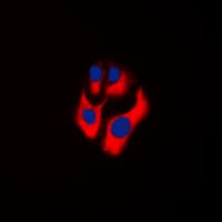 CKMT2 Antibody (Internal)