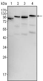 PathPlus™ BRAF / B-Raf Antibody (clone 1H12)