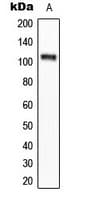 EEF2K Antibody (phospho-Ser366)