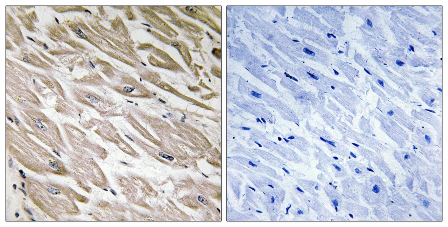 IPP2 / PPP1R2 Antibody (phospho-Ser120+Ser121)