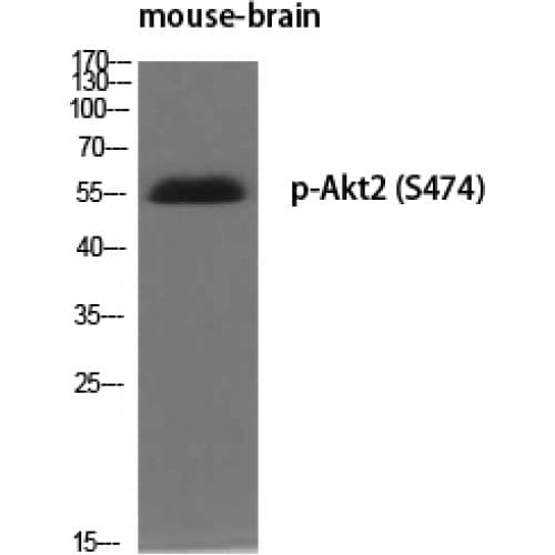 Polyclonal Rabbit anti-Human AKT2 Antibody (400-480 aa, IHC, WB)