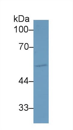 ALK2 / ACVR1 Antibody (aa208-340)