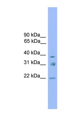 RNF167 Antibody (aa179-228)
