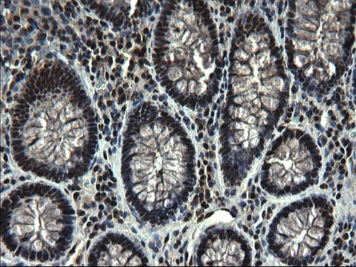 RPRD1B Antibody (clone OTI1C9)