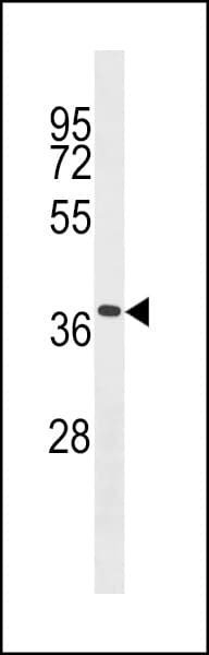 Polyclonal Rabbit anti-Mouse TMEM158 / RIS1 Antibody (aa179-206, WB)
