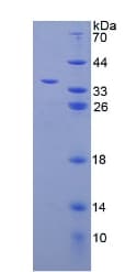 Human ERGIC-53 / LMAN1 Protein (Recombinant His-T7)