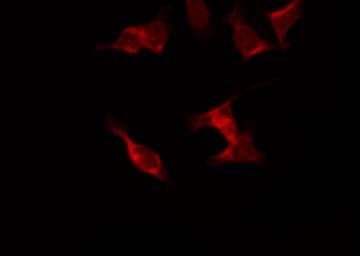 Polyclonal Rabbit anti-Human RPS6KB1 / P70S6K / S6K Antibody (phospho-Ser424, IHC, IF, WB)