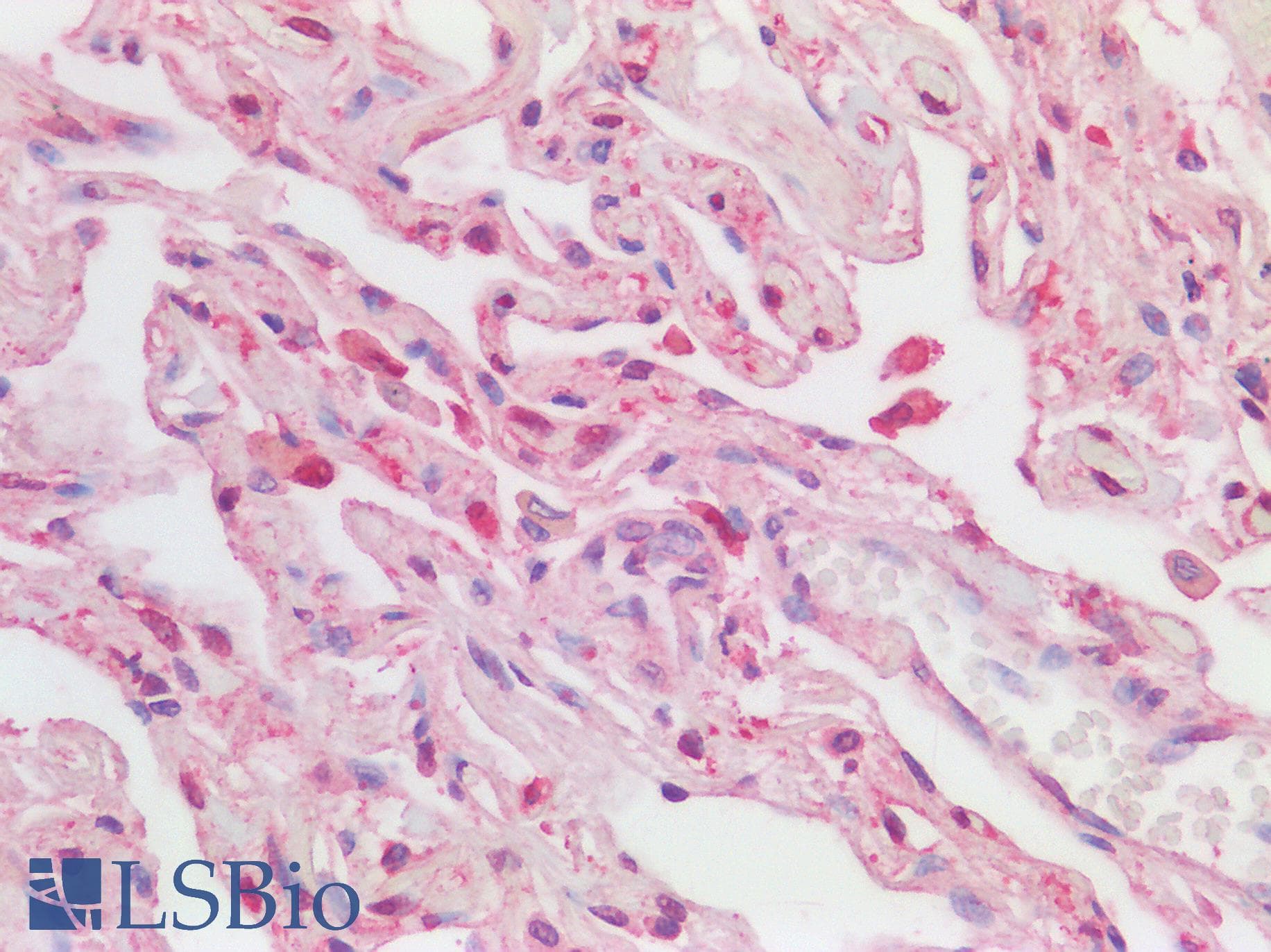Polyclonal Rabbit anti-Human LILRB2 / ILT4 Antibody (IHC, WB)
