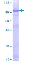 Human HLX1 / HLX Protein (Recombinant GST)