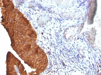 KRT19 / CK19 / Cytokeratin 19 Antibody (clone SPM561)