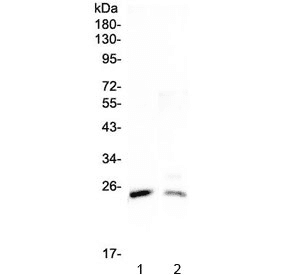 Polyclonal Rabbit anti-Mouse STAR Antibody (WB)