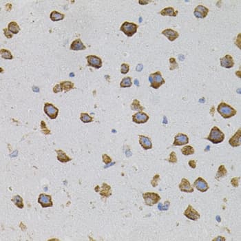 Polyclonal Rabbit anti-Human VEGFC Antibody (IHC, WB)