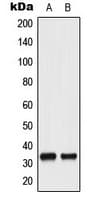 CDK1 / CDC2 Antibody (phospho-Tyr15)