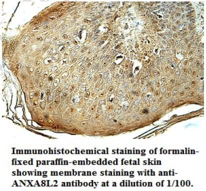 ANXA8L1 Antibody (aa77-265)