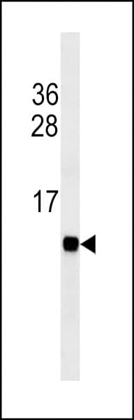 Monoclonal Mouse anti-Mouse FABP3 / H-FABP Antibody (WB)