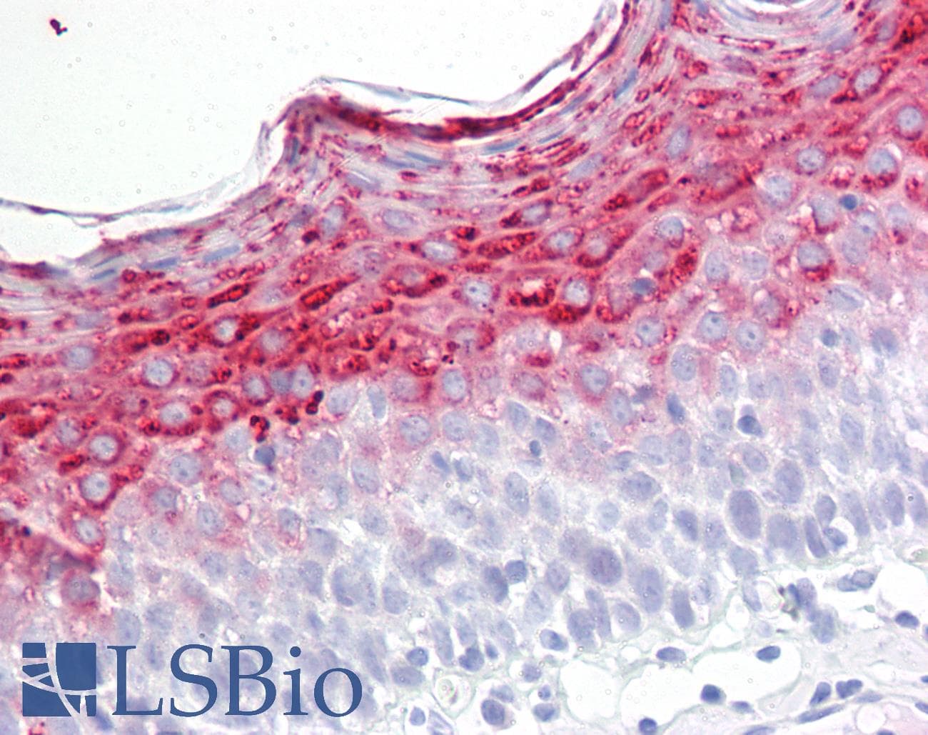 IHC-plus™ Polyclonal Rabbit anti-Human IVL / Involucrin Antibody (aa536-585, IHC, WB)