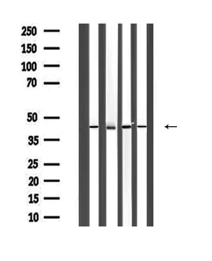 ACTA1 / Skeletal Muscle Actin Antibody