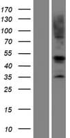 RAD51 / RECA Protein (Over-Expression Lysate Myc-DDK (Flag))