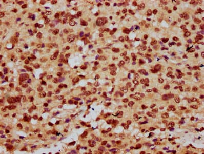 Polyclonal Rabbit anti-Human HIST1H3A Antibody (IHC, IF, WB)