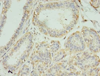 Polyclonal Rabbit anti-Human SCAMP4 Antibody (IHC)