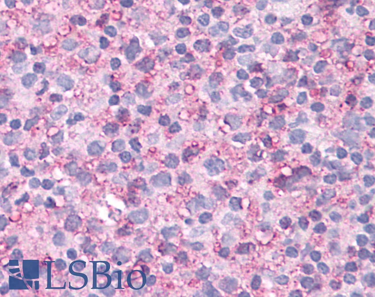 PathPlus™ NEK6 Antibody (N-Terminus)