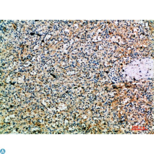 PRF1 / Perforin Antibody
