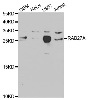 RAB27A / RAB27 Antibody