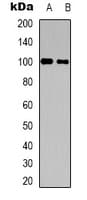 CNTROB Antibody (Internal)