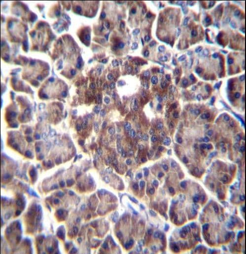 Polyclonal Rabbit anti-Human DDIT4 / REDD1 Antibody (aa198-227, IHC, WB)