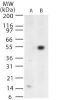 Polyclonal Rabbit anti-West Nile Virus WNV E Antibody (IHC, WB)