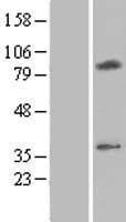 CMC2 / C16orf61 Protein (Over-Expression Lysate Myc-DDK (Flag))