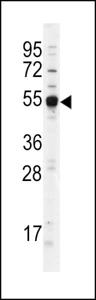 TRDMT1 / DNMT2 Antibody (aa346-375)