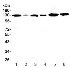 FLT1 / VEGFR1 Antibody