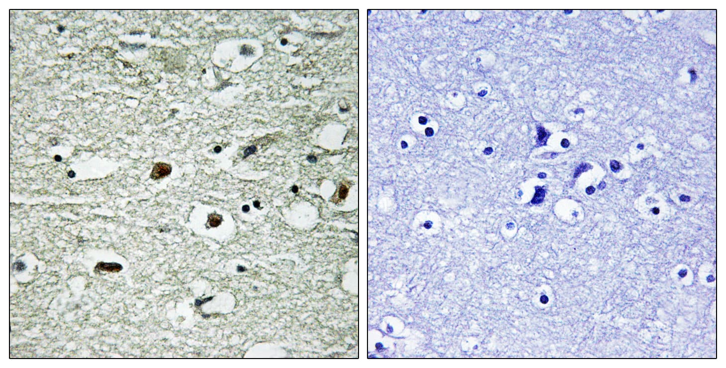 Polyclonal Rabbit anti-Human HNRNPC / HNRNP C Antibody (phospho-Ser260, IHC, WB)