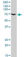 PRLR / Prolactin Receptor Antibody (clone 1E4)