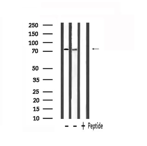 CEACAM5 / CD66e Antibody