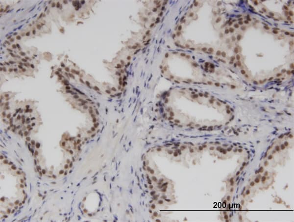 RBM6 / 3G2 Antibody (clone 3E9)